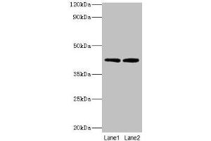 Western blot All lanes: LIAS antibody at 2 μg/mL Lane 1: MCF-7 whole cell lysate Lane 2: K562 whole cell lysate Secondary Goat polyclonal to rabbit IgG at 1/10000 dilution Predicted band size: 42, 37, 38 kDa Observed band size: 42 kDa (LIAS Antikörper  (AA 28-372))