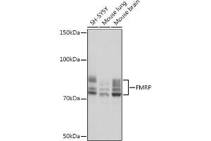Western blot analysis of extracts of various cell lines, using FMRP Rabbit mAb (ABIN1679778, ABIN3019025, ABIN3019026 and ABIN7101703) at 1:1000 dilution. (FMR1 Antikörper)