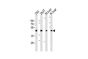 OAT Antibody (N-term) (ABIN652844 and ABIN2842548) western blot analysis in 293,293T cell line ,mouse liver and rat liver tissue lysates (35 μg/lane).