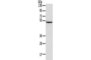 Gel: 8 % SDS-PAGE,Lysate: 40 μg,Primary antibody: ABIN7131472(TRIM14 Antibody) at dilution 1/800 dilution,Secondary antibody: Goat anti rabbit IgG at 1/8000 dilution,Exposure time: 3 seconds (TRIM14 Antikörper)
