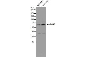 WB Image RGS7 antibody detects RGS7 protein by western blot analysis. (RGS7 Antikörper)