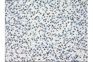 Immunohistochemical staining of paraffin-embedded Kidney tissue using anti-LTA4Hmouse monoclonal antibody. (LTA4H Antikörper)