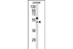 Western blot analysis of GNAT1 Antibody in Jurkat cell line lysates (35ug/lane) (GNAT1 Antikörper  (C-Term))
