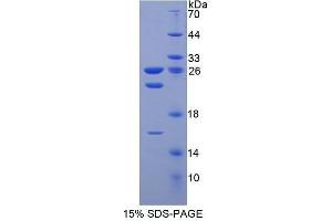 SDS-PAGE (SDS) image for Chromodomain Helicase DNA Binding Protein 3 (CHD3) (AA 1551-1742) protein (His tag) (ABIN2124335)