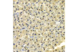 Immunohistochemistry of paraffin-embedded mouse pancreas using DKC1 Antibody (ABIN5970956) at dilution of 1/100 (40x lens). (DKC1 Antikörper)