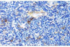 Immunohistochemistry of paraffin-embedded Human tonsil using PTCH1 Polyclonal Antibody at dilution of 1:100 (40x lens). (Patched 1 Antikörper)