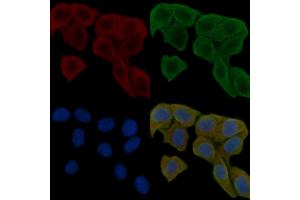 ABIN6260945 and ABIN6278818 staining Hela cells(30 min of UV treatment) by IF/ICC.