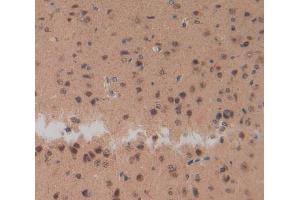 Used in DAB staining on fromalin fixed paraffin-embedded Brain tissue (NPS Antikörper  (AA 26-89))