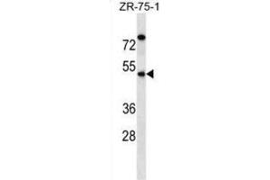 Western Blotting (WB) image for anti-Essential Meiotic Endonuclease 1 Homolog 2 (EME2) antibody (ABIN2998688) (EME2 Antikörper)