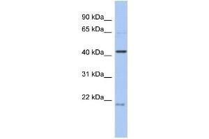 WB Suggested Anti-FAM98B Antibody Titration: 0. (FAM98B Antikörper  (N-Term))