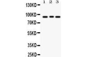 Western Blotting (WB) image for anti-Sema Domain, Immunoglobulin Domain (Ig), Short Basic Domain, Secreted, (Semaphorin) 3A (SEMA3A) (AA 550-771) antibody (ABIN3043328) (SEMA3A Antikörper  (AA 550-771))