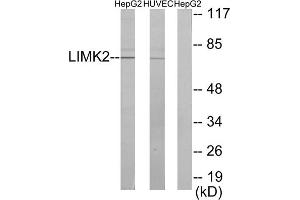 Western blot analysis of extracts from HepG2 cells and HUVEC cells, using LIMK2 antibody. (LIMK2 Antikörper  (Internal Region))