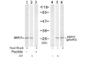 Image no. 2 for anti-Heat Shock 27kDa Protein 1 (HSPB1) (pSer82) antibody (ABIN197004) (HSP27 Antikörper  (pSer82))