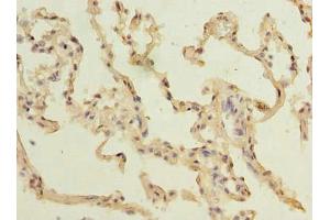 Immunohistochemistry of paraffin-embedded human lung tissue using ABIN7172926 at dilution of 1:100 (TM4SF1 Antikörper  (AA 115-161))