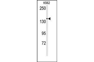 Image no. 1 for anti-Transient Receptor Potential Cation Channel, Subfamily M, Member 7 (TRPM7) (N-Term) antibody (ABIN360498)