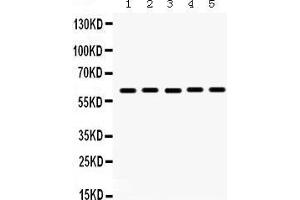 Western Blotting (WB) image for anti-Monoamine Oxidase A (MAOA) (AA 457-493), (C-Term) antibody (ABIN3043872)
