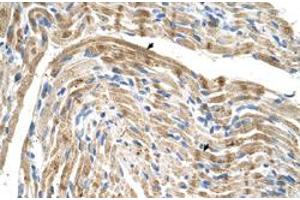 Immunohistochemical staining (Formalin-fixed paraffin-embedded sections) of human muscle with FADS1 polyclonal antibody  at 4-8 ug/mL working concentration. (FADS1 Antikörper  (C-Term))