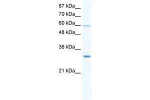 Western Blotting (WB) image for anti-DEAD (Asp-Glu-Ala-Asp) Box Polypeptide 31 (DDX31) antibody (ABIN2461359) (DDX31 Antikörper)