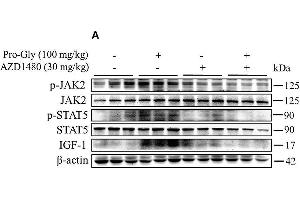 Western Blotting (WB) image for anti-Actin, beta (ACTB) (AA 1-50) antibody (ABIN724340)