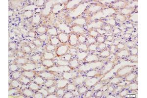 Formalin-fixed and paraffin embedded mouse kidney labeled with Anti-PTGER1 Polyclonal Antibody, Unconjugated (ABIN872820) at 1:200 followed by conjugation to the secondary antibody and DAB staining (PTGER1 Antikörper  (AA 61-160))