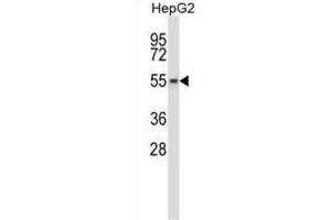 Western Blotting (WB) image for anti-WEE1 Homolog 2 (S. Pombe) (WEE2) antibody (ABIN2998010) (WEE2 Antikörper)