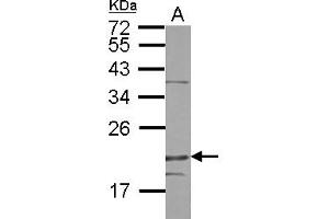Western Blotting (WB) image for anti-Density-Regulated Protein (DENR) (AA 1-198) antibody (ABIN1501885) (Density Regulated Protein Antikörper  (AA 1-198))