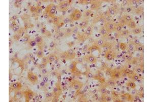 IHC image of ABIN7127534 diluted at 1:215 and staining in paraffin-embedded human liver tissue performed on a Leica BondTM system. (Rekombinanter Hepcidin Antikörper)