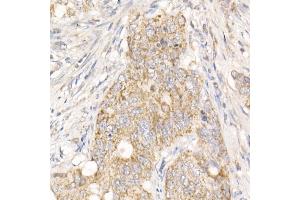 Immunohistochemistry (IHC) image for anti-Phosphoglycerate Mutase Family Member 5 (PGAM5) (AA 30-225) antibody (ABIN7269317)