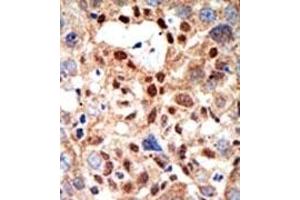 Image no. 2 for anti-Promyelocytic Leukemia (PML) (Sumoylation Site) antibody (ABIN357734) (PML Antikörper  (Sumoylation Site))