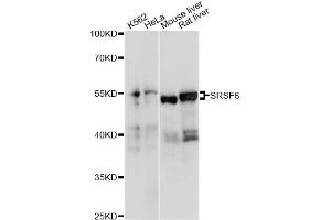 Western blot analysis of extracts of various cell lines, using SRSF6 antibody (ABIN6293560) at 1:1000 dilution. (SFRS6 Antikörper)