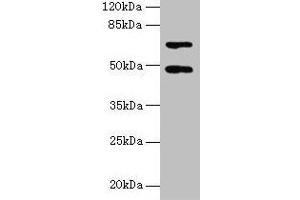 Western blot All lanes: HDAC3 antibody at 2 μg/mL + Hela whole cell lysate Secondary Goat polyclonal to rabbit IgG at 1/10000 dilution Predicted band size: 49, 50 kDa Observed band size: 49 kDa (HDAC3 Antikörper  (AA 1-428))