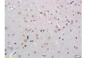 Formalin-fixed and paraffin embedded rat brain tissue labeled with Anti-KDM5B/PLU1/Jarid1B Polyclonal Antibody, Unconjugated  at 1:200 followed by conjugation to the secondary antibody and DAB staining