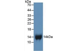 Western blot analysis of recombinant Human bTG. (beta-Thromboglobulin Antikörper  (AA 59-128))