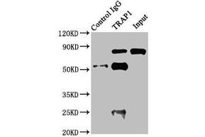 Immunoprecipitating TRAP1 in Jurkat whole cell lysate Lane 1: Rabbit control IgG instead of ABIN7154903 in Jurkat whole cell lysate. (TRAP1 Antikörper  (AA 60-308))
