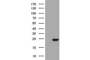 Western Blotting (WB) image for anti-Proteasome (Prosome, Macropain) Subunit, beta Type, 9 (Large Multifunctional Peptidase 2) (PSMB9) (AA 21-219) antibody (ABIN1491192) (PSMB9 Antikörper  (AA 21-219))