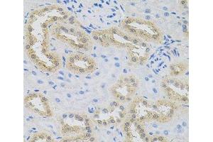 Immunohistochemistry of paraffin-embedded Rat kidney using HPS1 Polyclonal Antibody at dilution of 1:100 (40x lens). (HPS1 Antikörper)