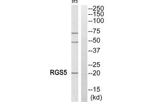 Western blot analysis of extracts from NIH/3T3 cells, using RGS5 antibody. (RGS5 Antikörper  (Internal Region))