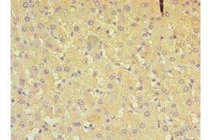 Immunohistochemistry of paraffin-embedded human liver tissue using ABIN7149648 at dilution of 1:100 (ALDH4A1 Antikörper  (AA 354-563))