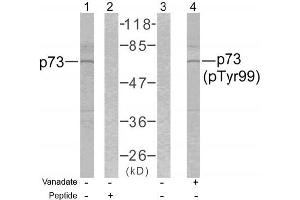 Image no. 1 for anti-Tumor Protein P73 (TP73) (pTyr99) antibody (ABIN196716) (Tumor Protein p73 Antikörper  (pTyr99))