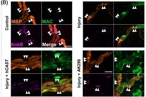 Nerve-muscle preparations from Glial or hCAST x Glial mice were treated acutely ex vivo with anti-GM1 Ab alone (Control) or with a source of complement (Injury) in the presence or absence of exogenous calpain inhibitor AK295.