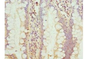 Immunohistochemistry of paraffin-embedded human small intestine tissue using ABIN7172749 at dilution of 1:100 (Protein C8orf4 (TCIM) (AA 1-106) Antikörper)
