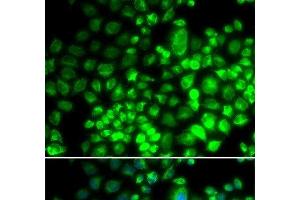 Immunofluorescence analysis of HeLa cells using ST6GAL1 Polyclonal Antibody (ST6GAL1 Antikörper)