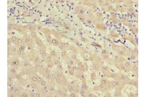 Immunohistochemistry of paraffin-embedded human liver tissue using ABIN7159418 at dilution of 1:100 (MIER2 Antikörper  (AA 1-545))