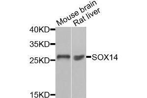 Western blot analysis of extracts of mouse brain and rat liver cells, using SOX14 antibody. (SOX14 Antikörper)