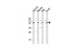 Western Blot at 1:2000 dilution Lane 1: 293T/17 whole cell lysate Lane 2: Ramos whole cell lysate Lane 3: Raji whole cell lysate Lane 4: Daudi whole cell lysate Lysates/proteins at 20 ug per lane. (FCRL4 Antikörper  (C-Term))