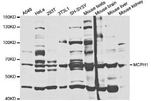 Western Blotting (WB) image for anti-Microcephalin 1 (MCPH1) antibody (ABIN1876660) (MCPH1 Antikörper)