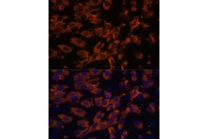 Immunofluorescence analysis of C6 cells using PRX antibody (ABIN7269215) at dilution of 1:100. (Periaxin Antikörper  (AA 1250-1350))