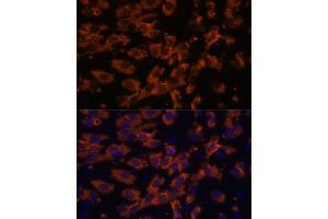 Immunofluorescence analysis of C6 cells using PRX antibody (ABIN7269215) at dilution of 1:100. (Periaxin Antikörper  (AA 1250-1350))