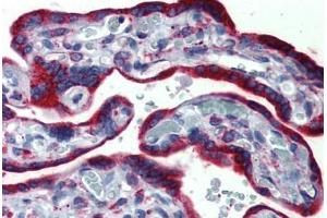 Human, Placenta: Formalin-Fixed Paraffin-Embedded (FFPE) (ERP44 Antikörper  (C-Term))