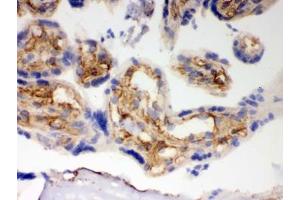 Immunohistochemistry (IHC) image for anti-BCL2-Antagonist/killer 1 (BAK1) (AA 22-211) antibody (ABIN4950296)
